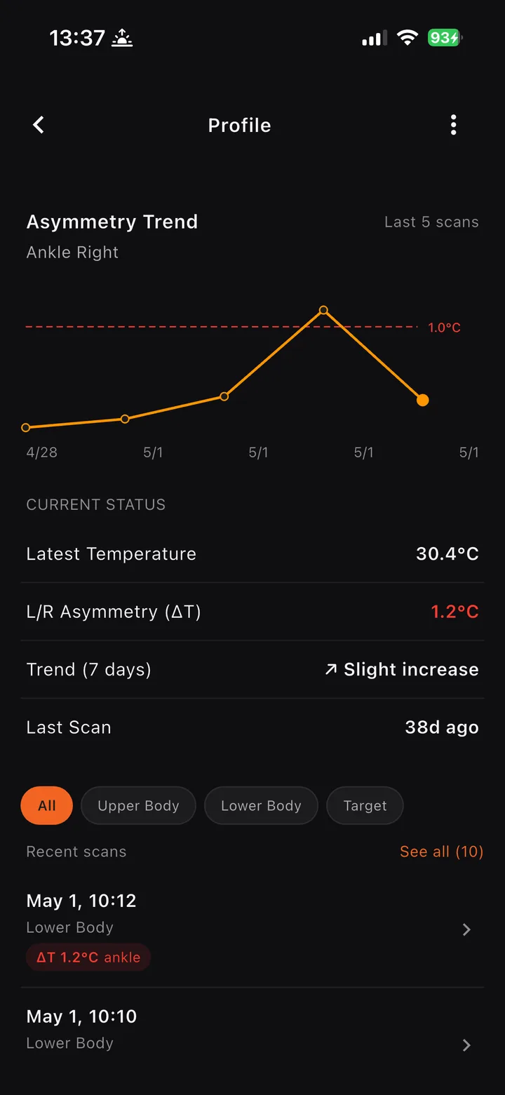 Asymmetry trend chart on iPhone